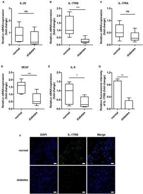 Interleukin-25-Mediated-IL-17RB Upregulation Promotes Cutaneous Wound Healing in Diabetic Mice by Improving Endothelial Cell Functions